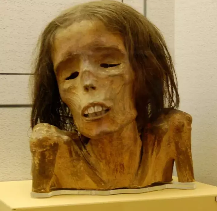 Where to See the World’s Most Famous Preserved Body Parts