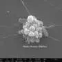 Extracellular vesicle discovery may shed light on how cancer spreads