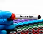 ‘Ferritin face’: are social media claims about iron deficiency fact – or fiction?
