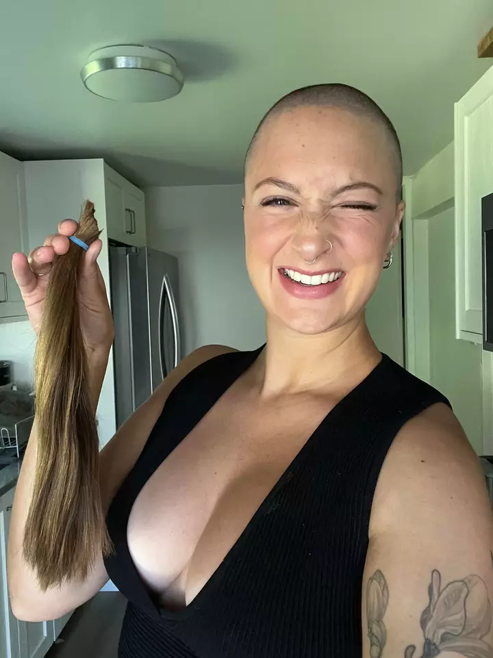 How Shaving My Head Helped Me Embrace My Psoriasis