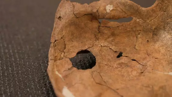 Was This Neanderthal Murdered?